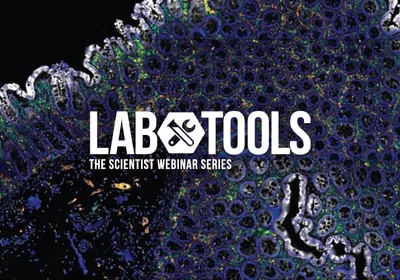 Efficient and Flexible Spatial Multiplexing: Assay Development Guidelines for ChipCytometryTM